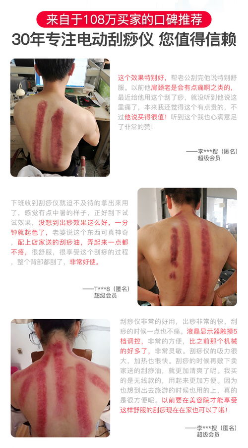 御圣坊家用無(wú)線電動(dòng)刮痧儀 便捷養(yǎng)生，全身適用，限時(shí)特惠僅98元